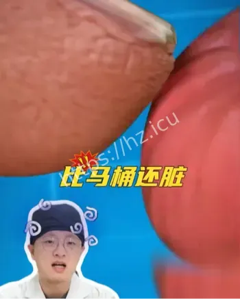 咬指甲危害
